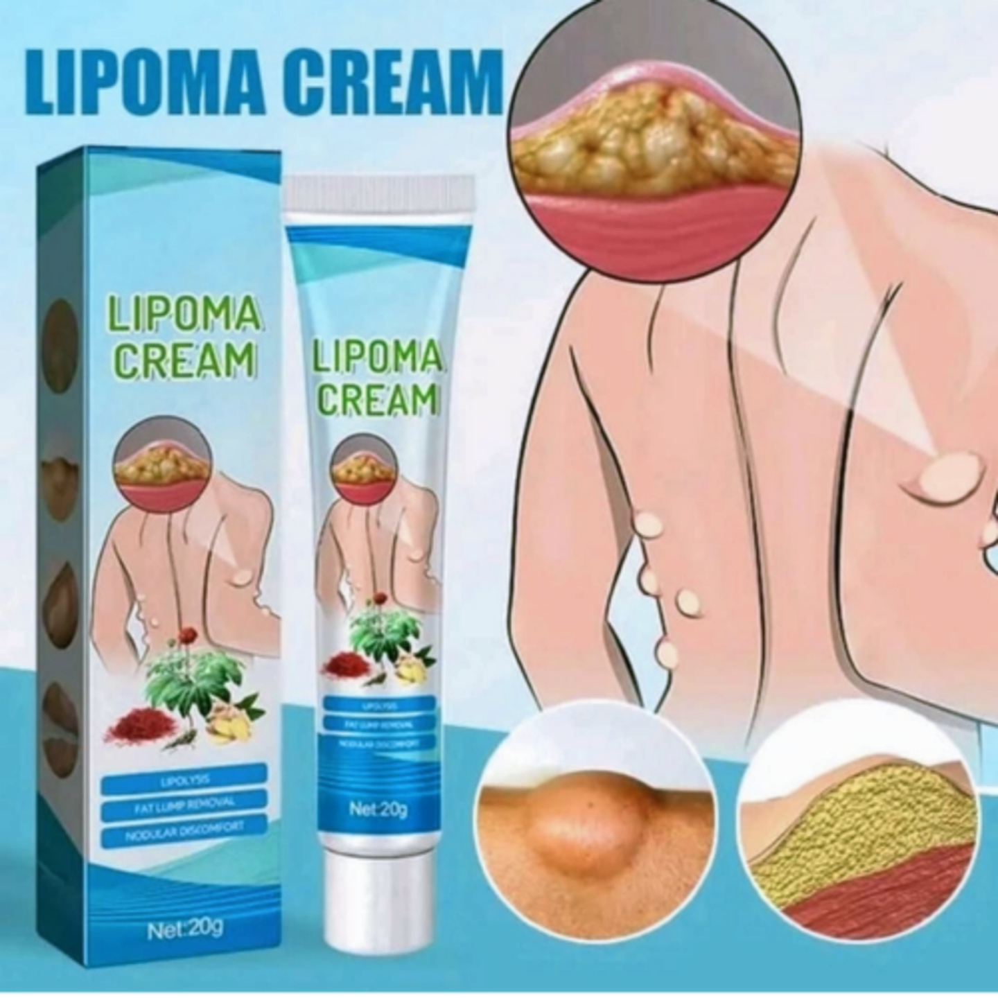 South Moon™ Lipoma Treatment Ointment